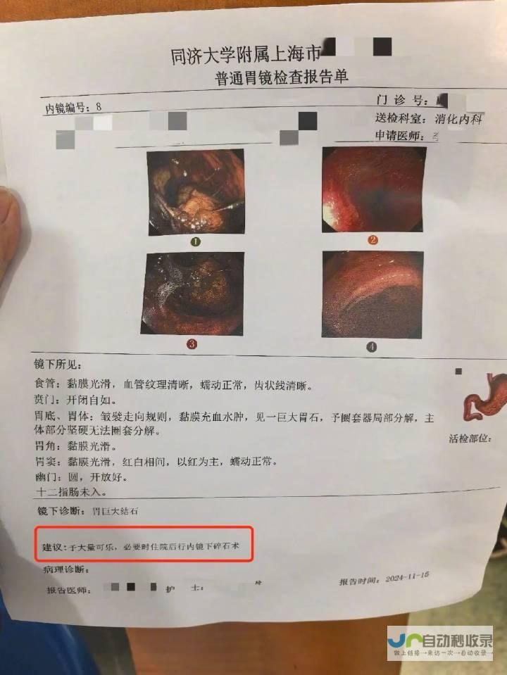 专家提醒需遵医嘱，胃部健康不容忽视